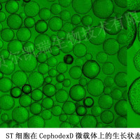 ST细胞在CephodexD型微载体上的生长状态