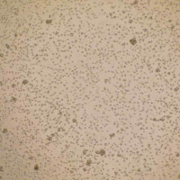 BCL2 (AAA) Jurkat_儿童急性T淋巴细胞白血病