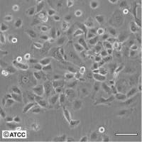 人胚肺成纤维细胞MRC-5