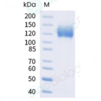Recombinant Human IL-31RA Prot
