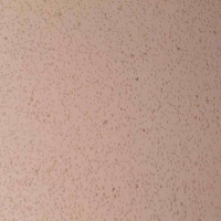 BCL2 (S87A) Jurkat_儿童急性T淋巴细胞白血