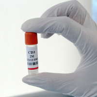 CD3+（Positive）T细胞
