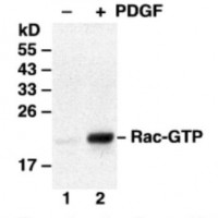 Rac  Activation Assay Kit