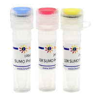 SUMO Protease