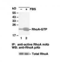 RhoA Activation Assay Kit