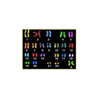 CW2047 Du145 前列腺癌细胞  细胞系