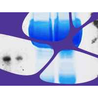 EZ-Magna ChIP™ A/G Chromatin I