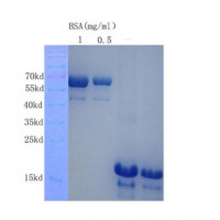 TNFAIP6| Human Tumor necrosis
