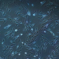 基因敲除稳转细胞株 HeLa-SirT4-KO