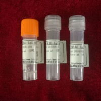 人载脂蛋白A1（ApoA1)