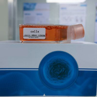 ZR-75-1+luc人乳腺癌细胞荧光素酶标记