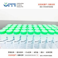 MIP-1β/CCL4 Protein，Human  【中文
