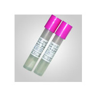 批发供应 各类检验耗材--压力蒸汽灭菌生物指示剂 优惠销售