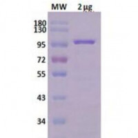 Taq DNA Polymerase