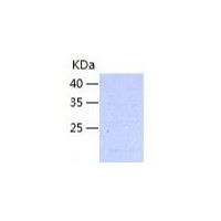 人 XCL2重组蛋白丨Recombinant Human X