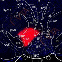 霍乱毒素 B 亚基（Cholera Toxin Subuni