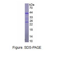 CD5分子(CD5)重组蛋白