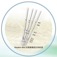 抗梅毒螺旋体抗体检测（免疫印迹法）