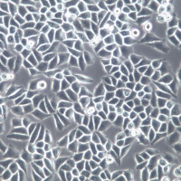 Hep-2细胞系、Hep-2细胞、Hep-2喉癌上皮细胞