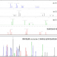 21三体、13三体、18三体和性染色体多倍体分析试剂盒 Hu