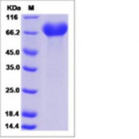 Recombinant Human EphA1 Protei