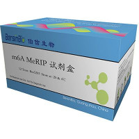 m6A MeRIP试剂盒(含m6A抗体）（m6A MeRIP