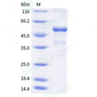Recombinant Human 4-1BB Ligand