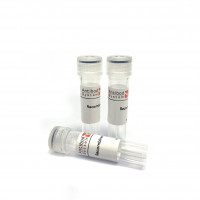Terminal Transferase (TdT)