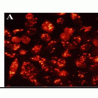 RFect PM  Transfection Reagent