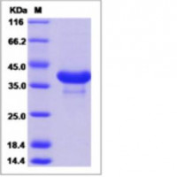 Recombinant Mouse CD81 Protein
