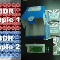 HLA ABDR SSP分型试剂
