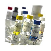 人波形蛋白(Vimentin)