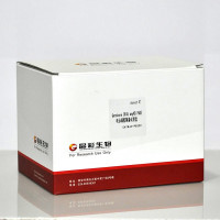 Genshare CFAS any KD PAGE蛋白电泳试