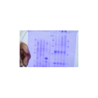 SDS-PAGE