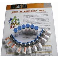 人肌红蛋白(MYO/MB)ELISA试剂