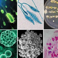 磁珠法病原微生物DNA/RNA提取试剂盒