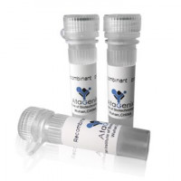 TEV Protease(烟草蚀纹病毒蛋白酶)