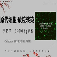原代细胞质粒转染试剂