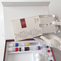 Arthrobacter equi马节杆菌染料法荧光定量PC