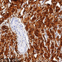 中杉金桥  ZA-0026  Calretinin 抗体试剂
