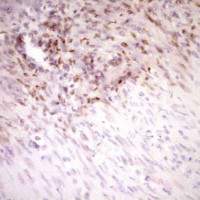 中杉金桥  TA806750  试剂Stabilin2