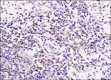 Paraffin-embedded rat tumor tissue is stained with CD19 Antibody (Cat. No. 250585) used at 1:200 dilution.