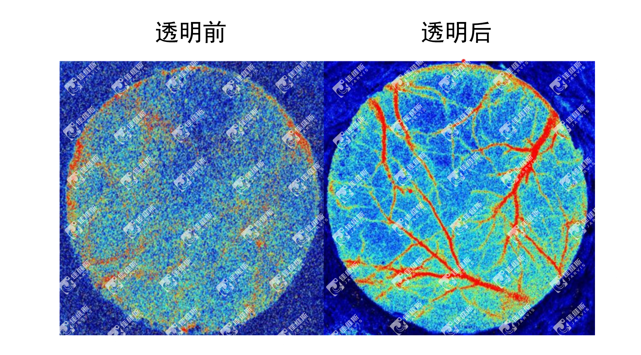 活体颅骨透明前后激光散斑成像